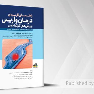 راهنمای کاربری درمان واریس با روش های کم تهاجمی