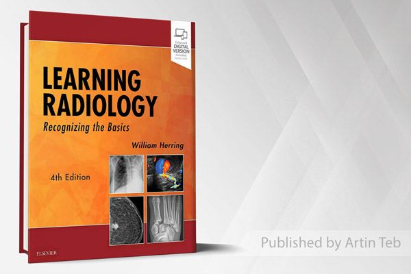 2024 Learning Radiology Recognizing the Basics - William Herring - 4th Edition