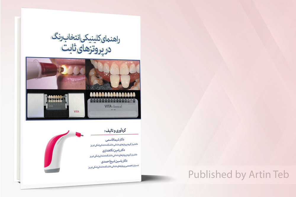 راهنمای کلینیکی انتخاب رنگ در پروتز های ثابت
