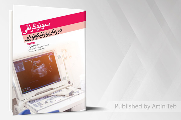 سونوگرافی در زنان و ژنیکولوژی